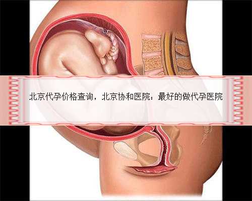 北京代孕价格查询，北京协和医院：最好的做代孕医院