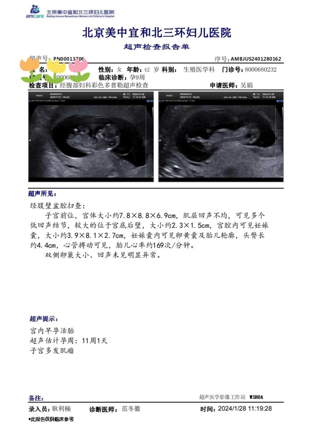 阜阳供卵哪里有40岁供精供卵好口碑代怀机构