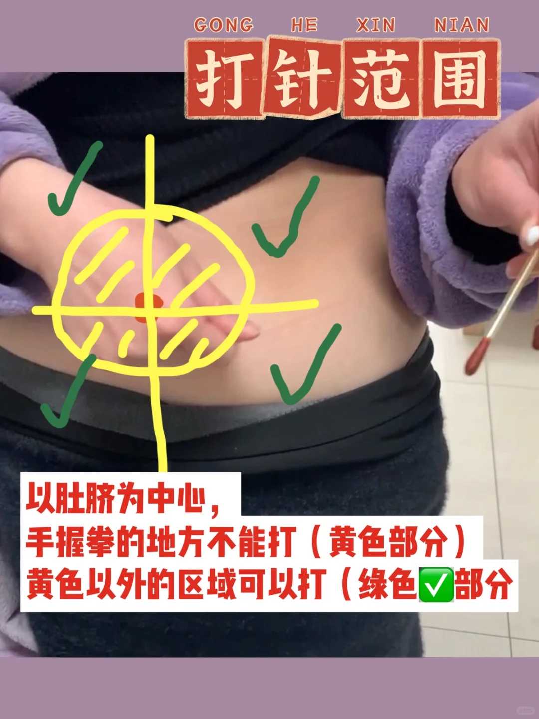 多囊卵巢做试管婴儿要多久时间？