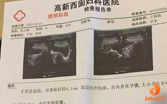 北京借卵代怀，【哪里有做供卵试管的医院】望孕妈妈都能开开心心的迎接小生